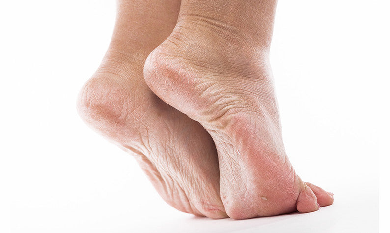 Why Are My Feet So Dry? Your Guide to Foot Repair