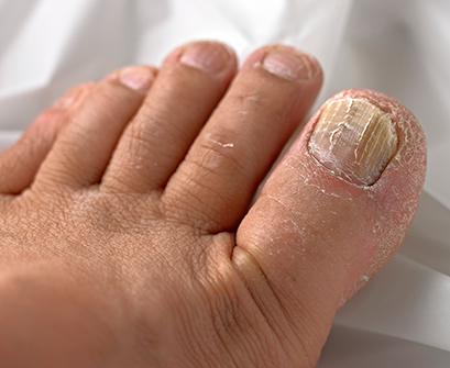 What your toenails say about your health can be conveyed by color