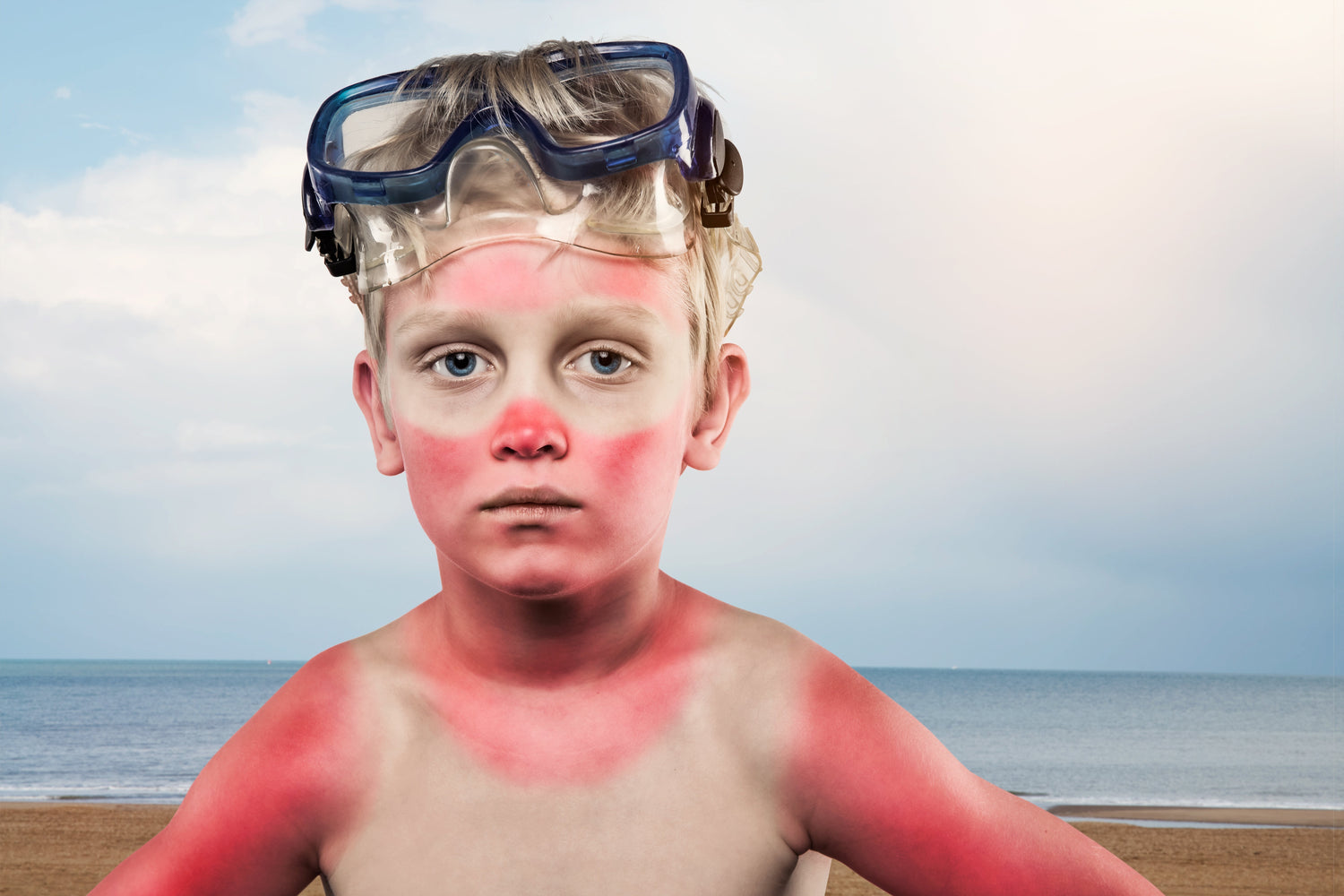 Sunburn Relief: How Aloe Vera Helps Soothe Sun-Damaged Skin